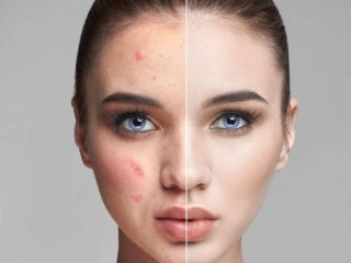 Dermatology 1