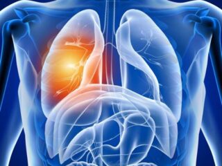Pulmonology 1 (2)